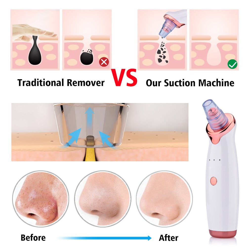 Multi-Function Electric Blackhead Remover