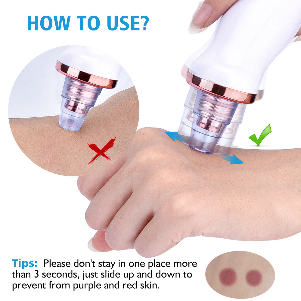 Multi-Function Electric Blackhead Remover