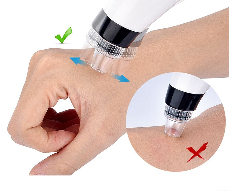 Multi-Function Electric Pore Cleaner
