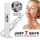 Blue Light Therapy Acne Pen