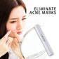 Blue Light Therapy Acne Pen